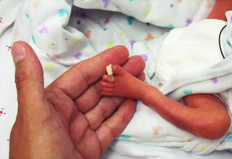 An ‘artificial womb’ could give premature babies a fighting chance