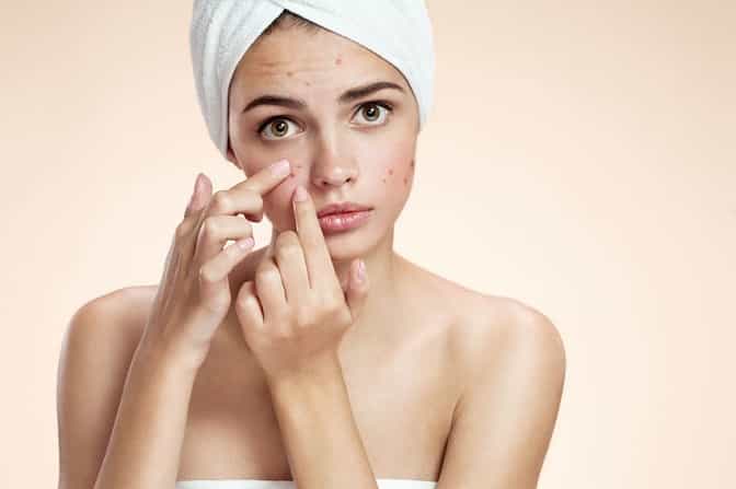 The simple nightly skincare habit that can result in acne breakouts The simple nightly skincare habit that can result in acne breakouts