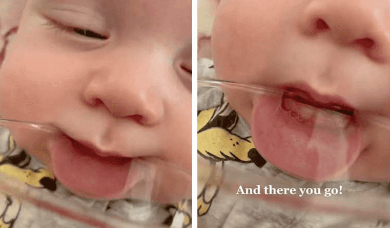 This clever trick makes it easy to know if your baby has started teething