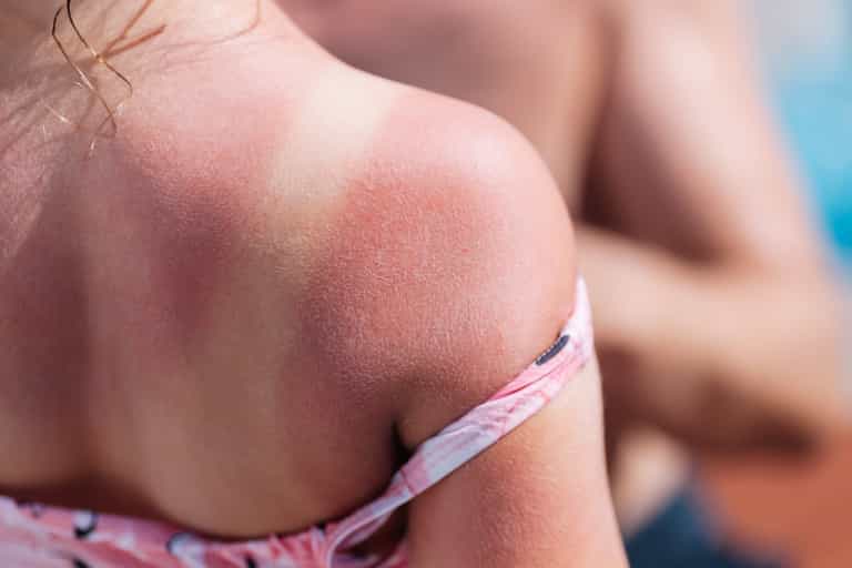 Stock up on suncream – Met Éireann says heat wave is here to stay as charity warns of sunburn Stock up on suncream – Met Éireann says heat wave is here to stay as charity warns of sunburn