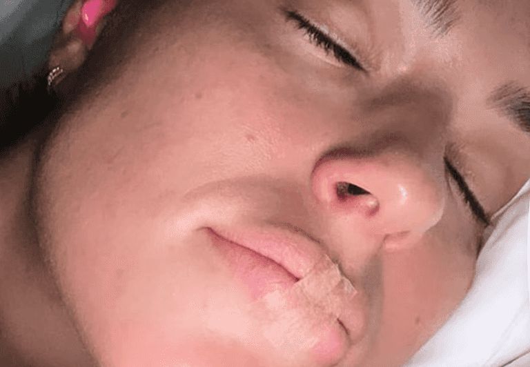 Ashley Graham sleeps with tape over her mouth – but exactly what is taping? Ashley Graham sleeps with tape over her mouth – but exactly what is taping?