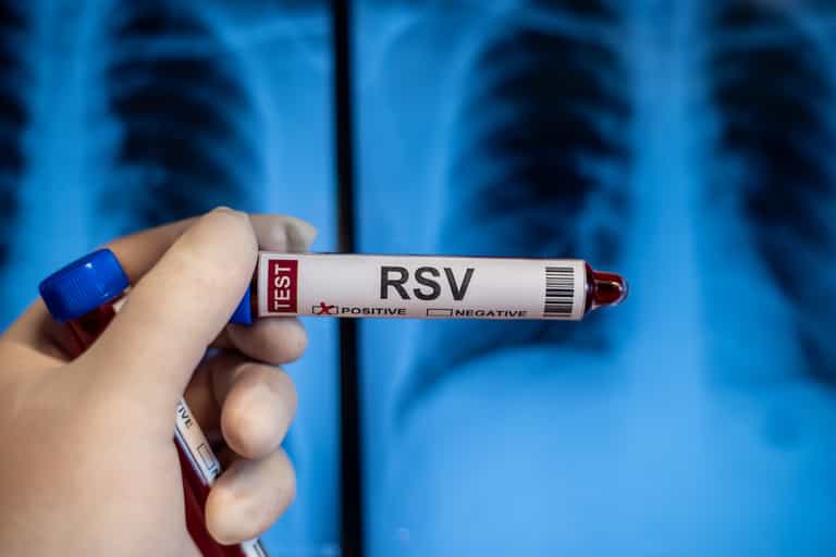 ‘We’ve seen a very significant recent rise’ – HSE warns parents over contagious respiratory disease in kids ‘We’ve seen a very significant recent rise’ – HSE warns parents over contagious respiratory disease in kids